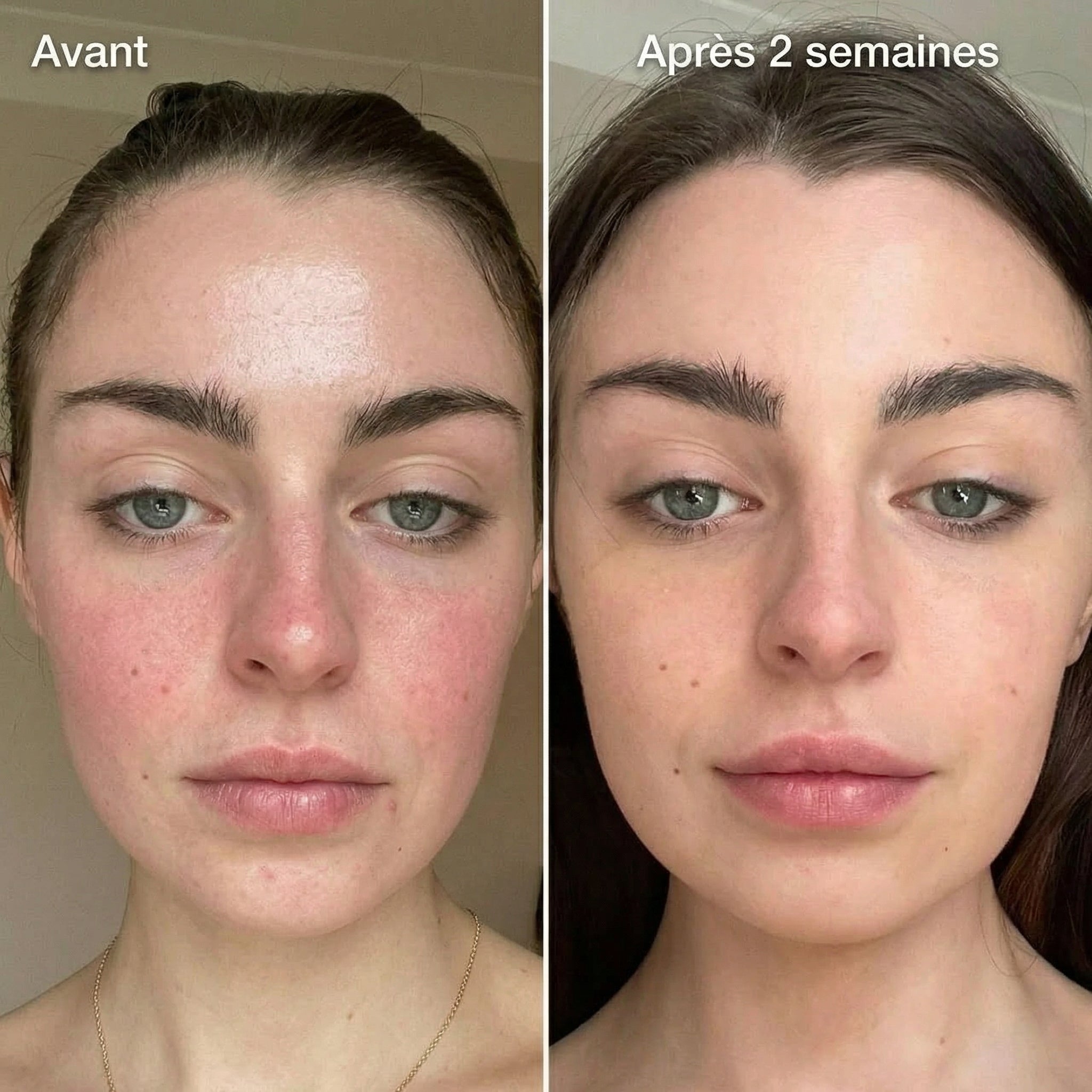 Seruvia Sérum Anti-Rougeurs