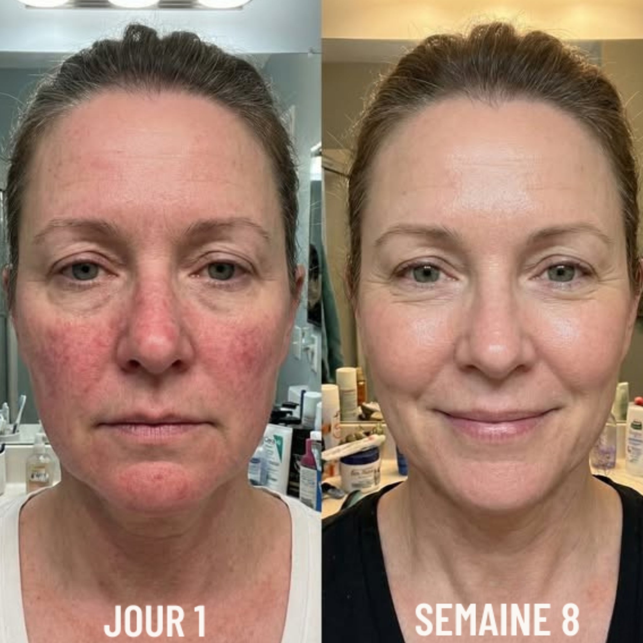 Seruvia Sérum Anti-Rougeurs